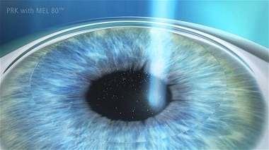 CUANTO CUESTA UNA OPERACIÓN DE OJOS EN ESTADOS UNIDOS 10