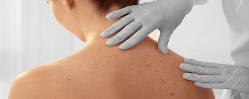 cuanto gana un dermatologo en estados unidos 1